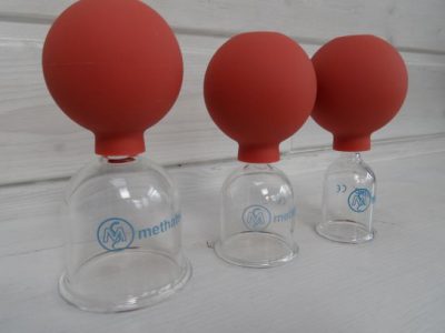 Schröpfkopfmassage Schröpfkopfmassage